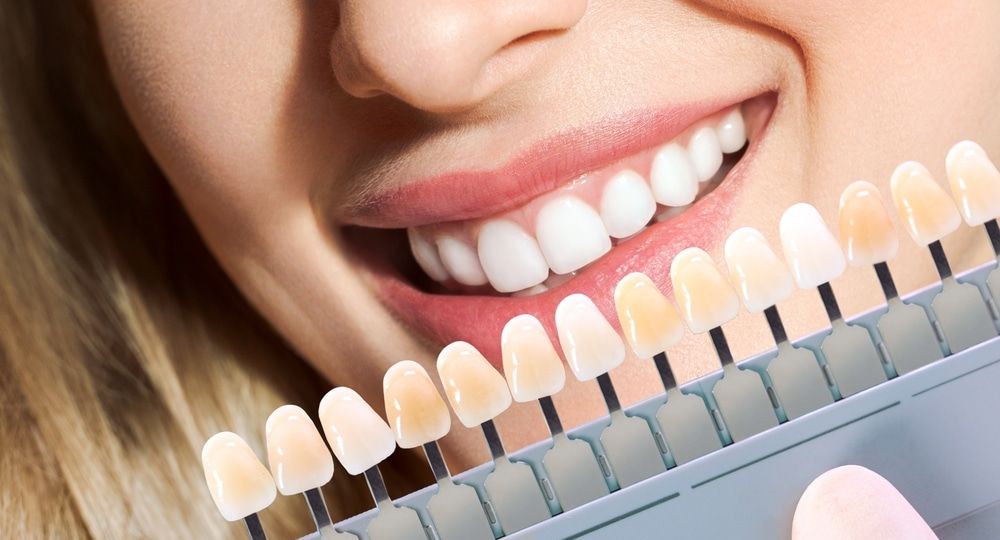 Doctor,Matching,Patient's,Teeth,Color,With,Palette,,Closeup.,Cosmetic,Dentistry