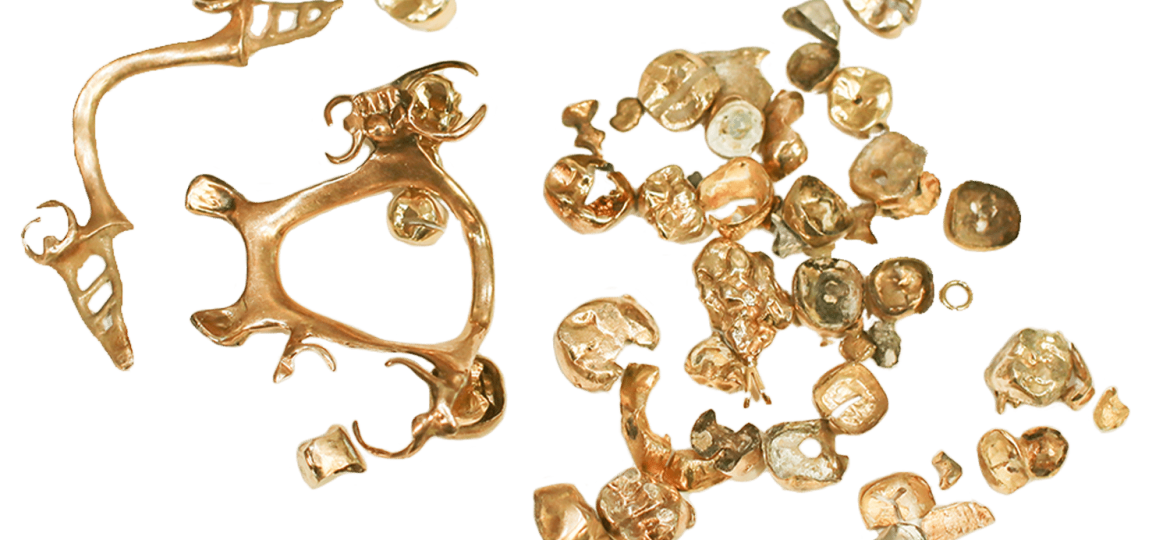 Blog dental scrap image